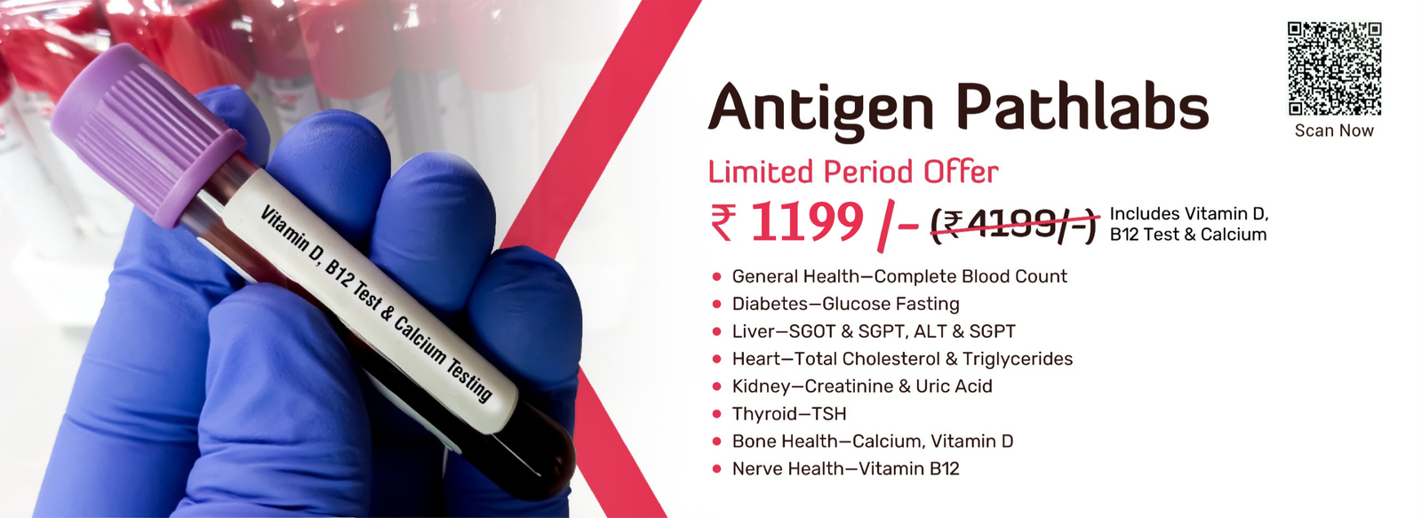 Antigen Pathlabs limited period offer &ndash; full health check at Rs 1199 including Vitamin D, B12 and Calcium