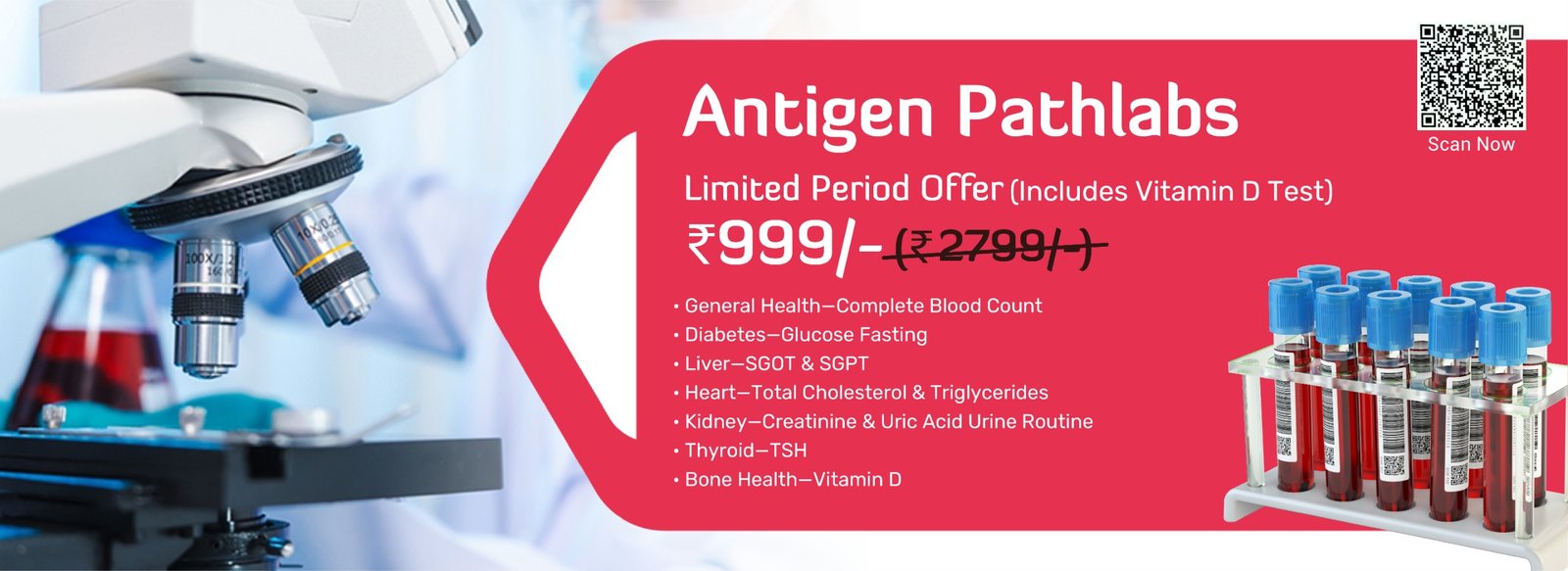 Antigen Pathlabs limited period offer &ndash; health check at Rs 999 including Vitamin D test