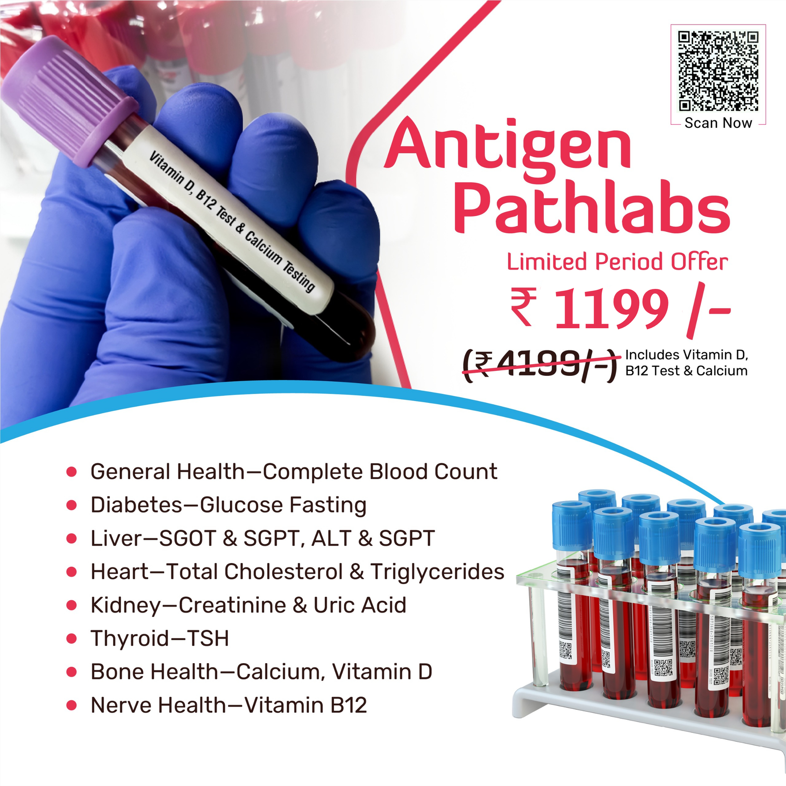 Antigen Pathlabs limited period offer &ndash; full health check at Rs 1199 including Vitamin D, B12 and Calcium