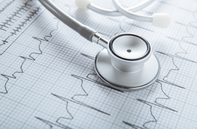 ECG test